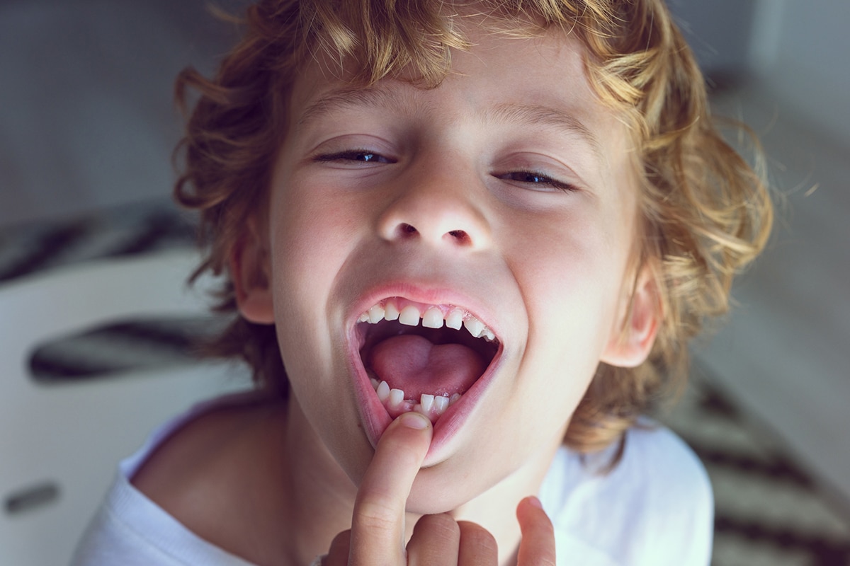 My Child Knocked Out a Permanent Tooth: What Should I Do First?