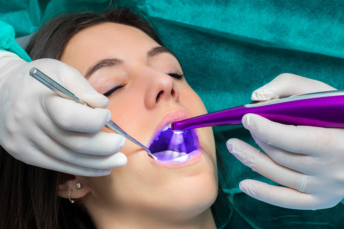 Signs your child may need dental sealants sooner than you think blog