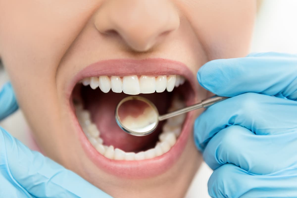 The Importance Of Early Dental Care Blog