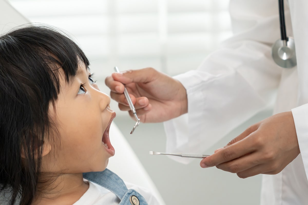 What are white fillings for kids and are they better than silver blog